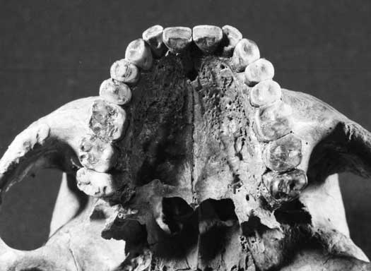 Dental health in the Mesolithic period